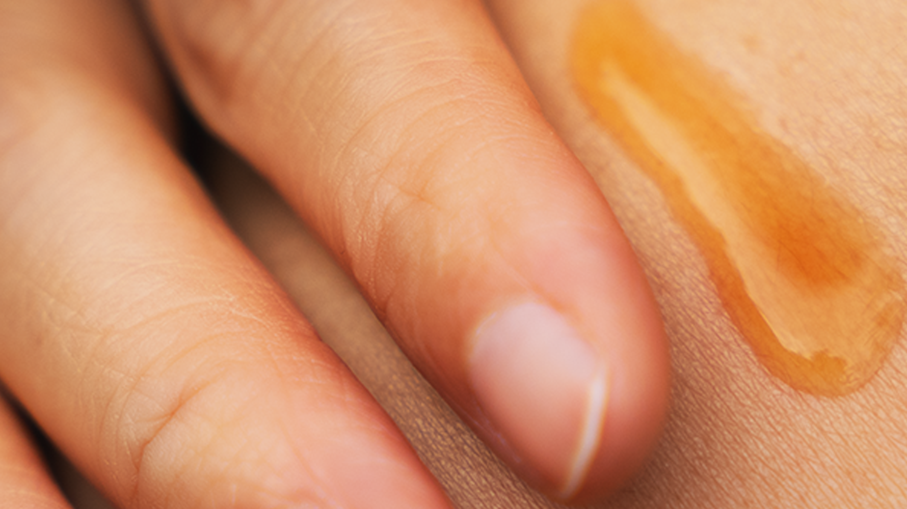 why transparency matters