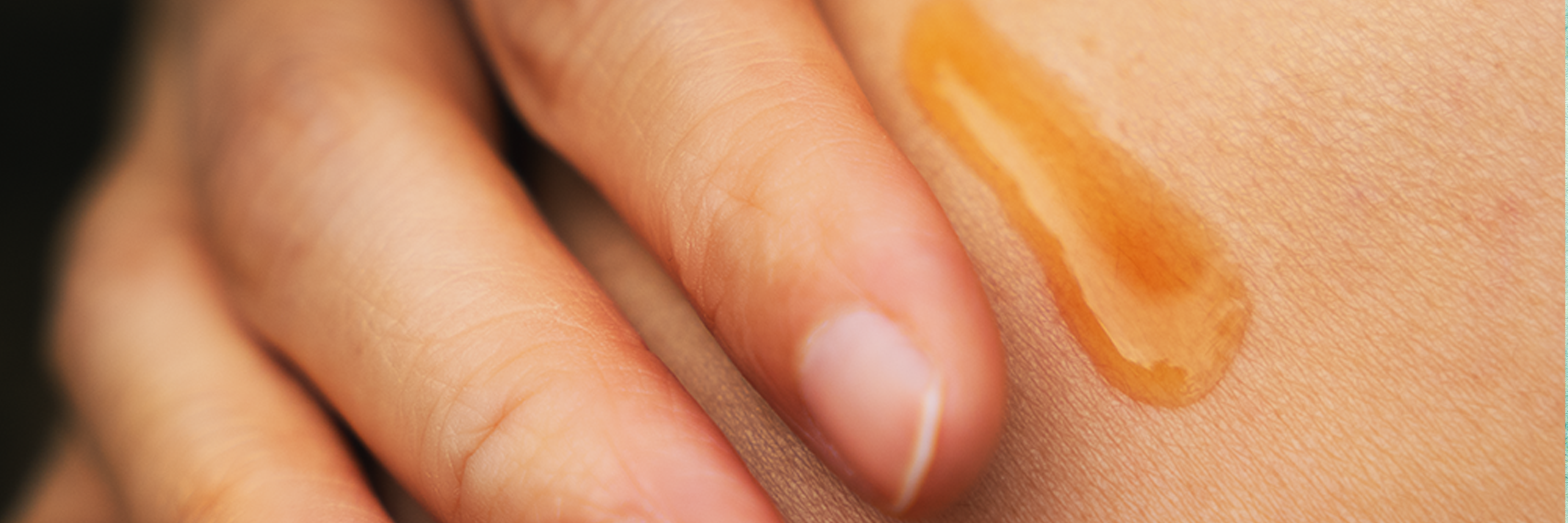 why transparency matters